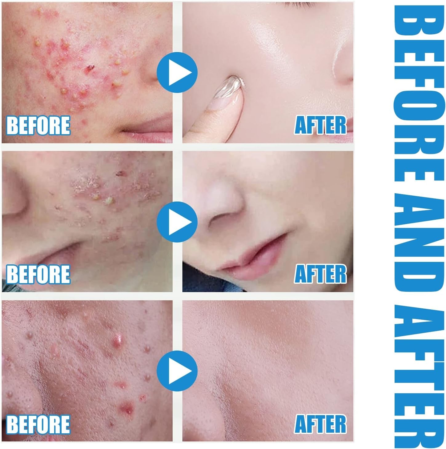 Hyaluronic Acid Facial Serum, Facial Serum with Hyaluronic Acid Moisturising Face Serum, Lightweight and Ultra Moisturising Anti-Aging Facial Serum, for All Skin Types