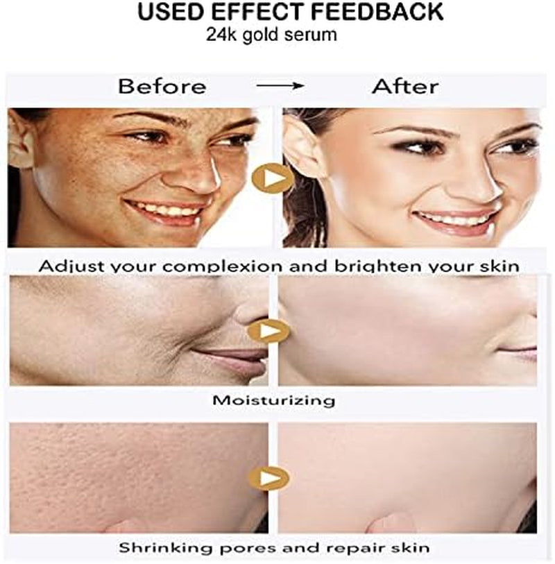 , 24K Gold Serum Moisturizing Essence, 99% Pure Gold Anti-Aging Essence, Nourishing Anti-Aging Gold Serums for Face Skin Anti-Aging Skin Repair Moisture Firming Lifting Skin