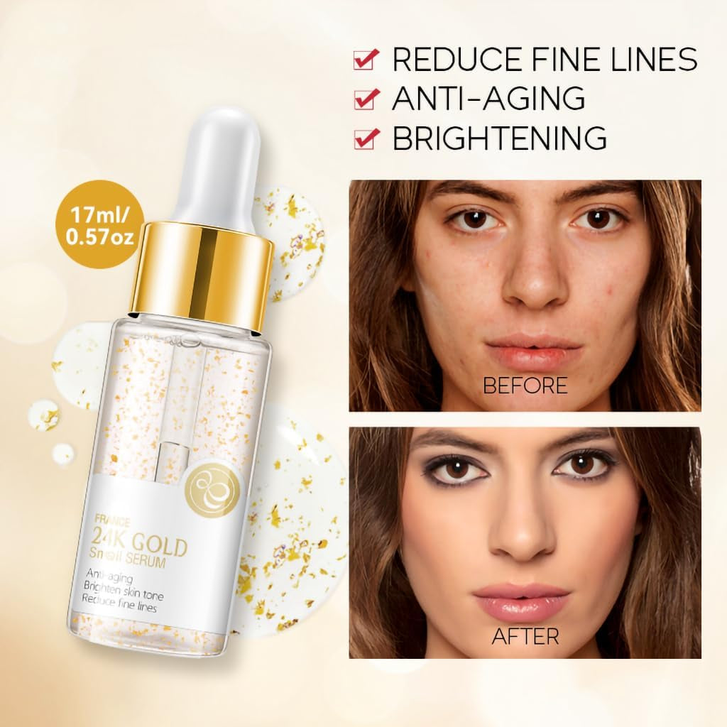 24K Mucin Snail Essence, Snail Mucin Serum Face Moisturiser with Hyaluronic Acid Serum, Niacinamide Serum, Ginseng Extract, Skincare for Hydrating, Anti-Wrinkle, Even Skin Tone