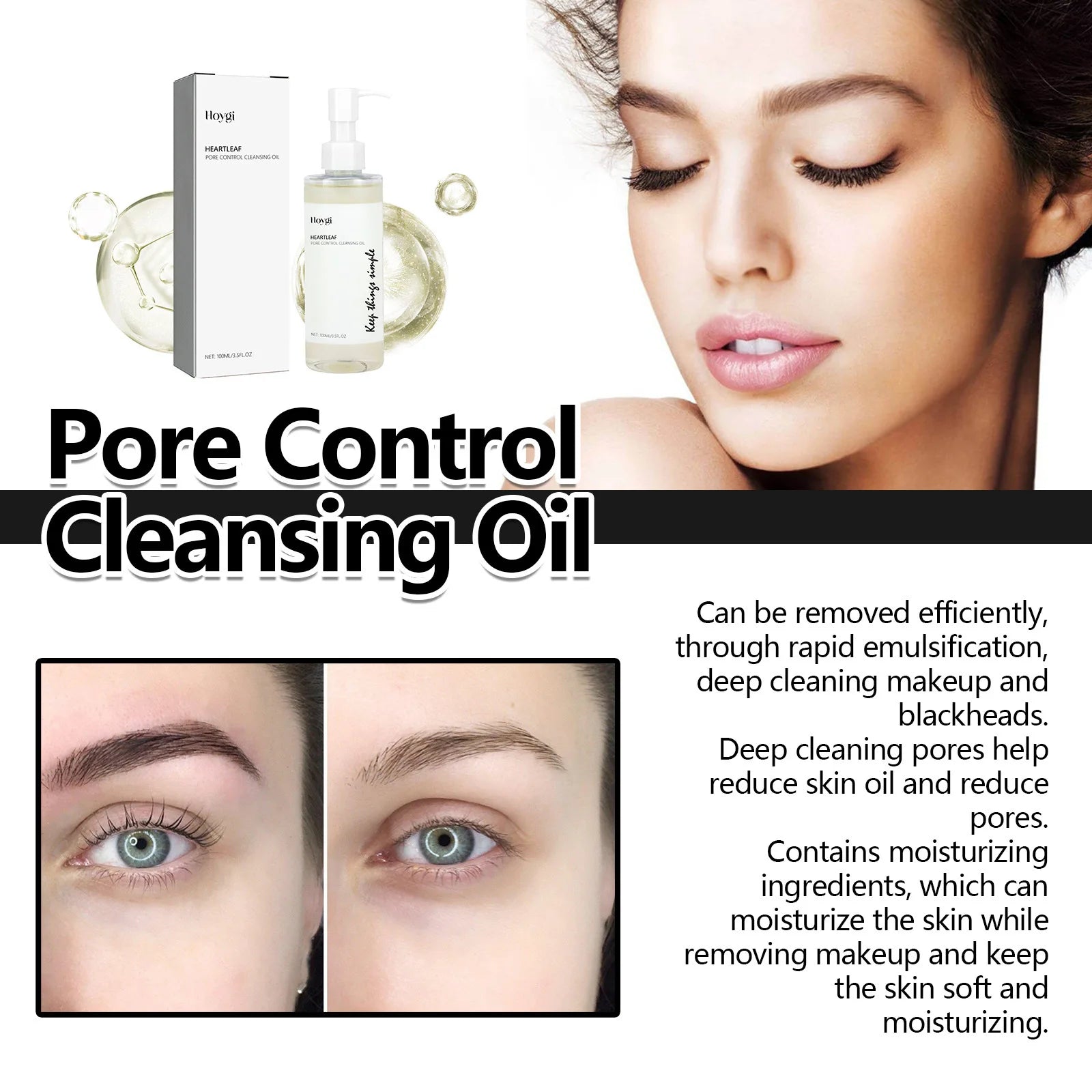Niacinamide Serum Dark Spot Correcting Moisturizing Brightening Cleaning Pores Fade Fine Lines Makeup Remover Korean Skin Care