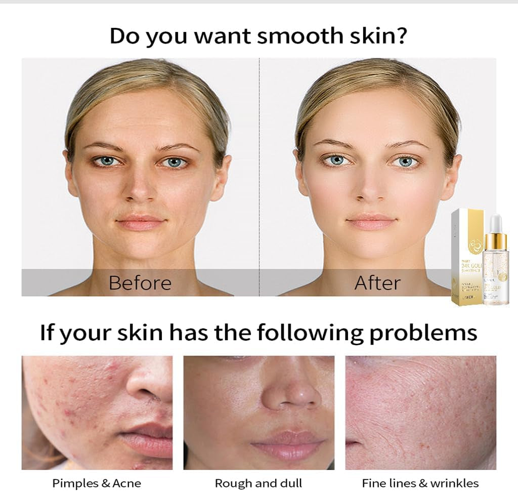 24K Mucin Snail Essence, Snail Mucin Serum Face Moisturiser with Hyaluronic Acid Serum, Niacinamide Serum, Ginseng Extract, Skincare for Hydrating, Anti-Wrinkle, Even Skin Tone